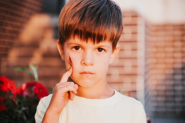 Portrait d'un garçon mignon avec une ecchymose sur son visage