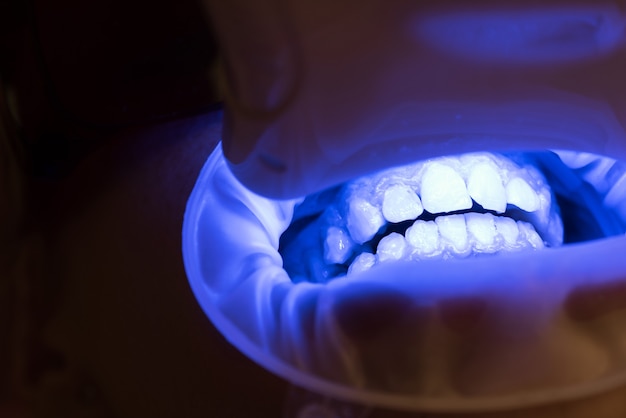 Photo portrait de gros plan d'une patiente au dentiste à la clinique. jeune femme blonde ouvrant la bouche alors que dentiste non identifiable dans des gants en latex vérifier l'état de ses dents