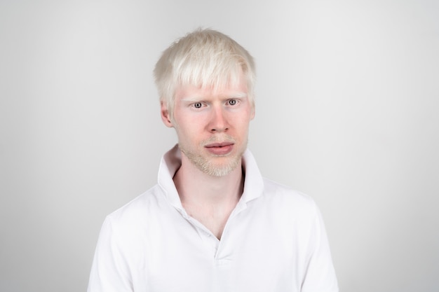 Portrait d'un homme albinos dans un studio