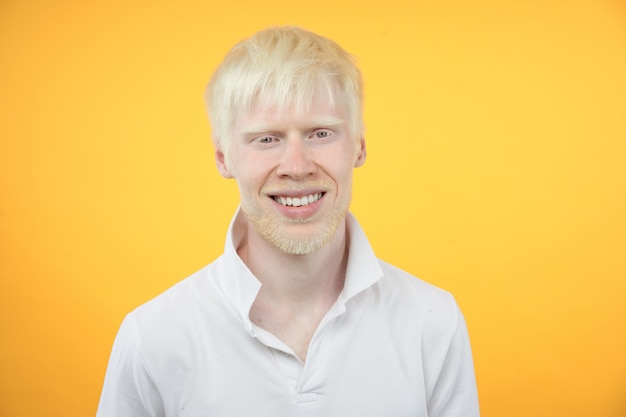 Portrait d'un homme albinos dans un studio