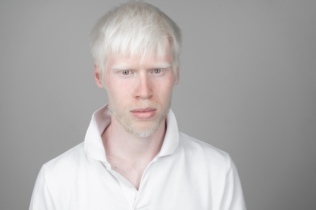Portrait d'un homme avec un albinos sur un fond gris