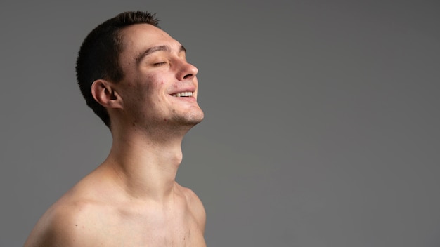 Portrait de jeune homme avec de l'acné et de l'espace de copie