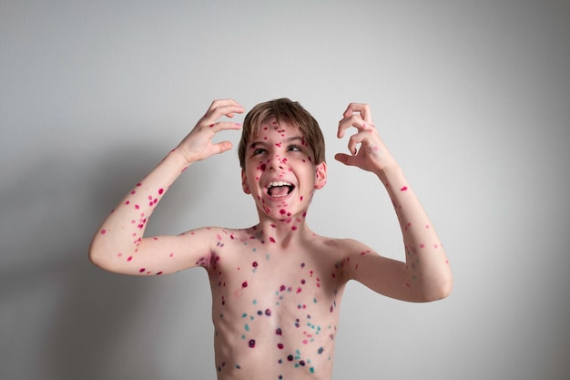 Portrait d'un petit garçon émotif avec la varicelle sur le fond d'un mur gris