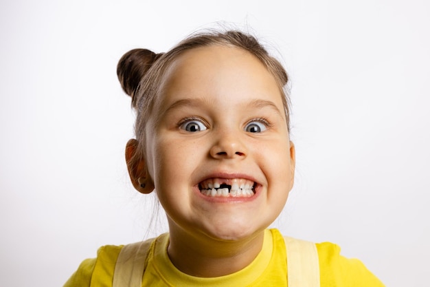 Portrait d'une petite fille montrant une dent de bébé avant manquante et souriant follement avec des yeux exorbités en t-shirt jaune sur fond blanc Premiers changements de dents Aller chez le dentiste pour faire un traitement dentaire