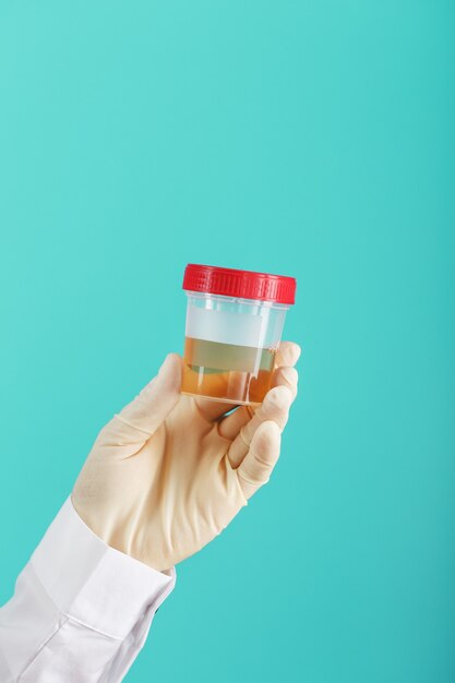 Pot isolé avec une analyse de laboratoire de l'urine dans la main du médecin