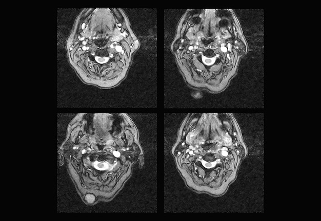 Professionnel de l'IRM et de la tomodensitométrie du rachis cervical