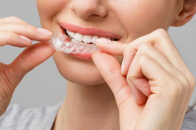 Protège-dents pour le blanchiment des dents une jeune femme fait une procédure de blanchiment des dents à domicile