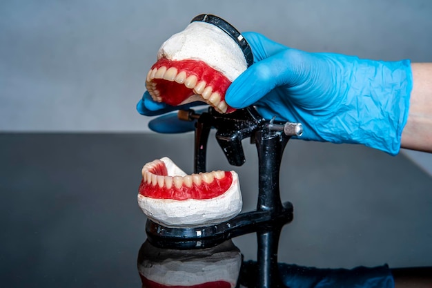 Prothèse dentaire dans les mains du médecin gros plan Dentiste tenant un pont dentaire en céramique Vue de face de la prothèse complète Dentisterie photo conceptuelle Dentisterie prothétique