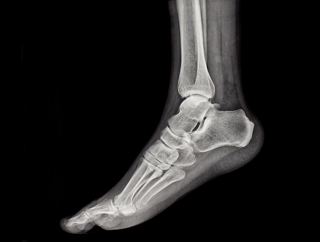 Une radiographie du pied et de la cheville humains