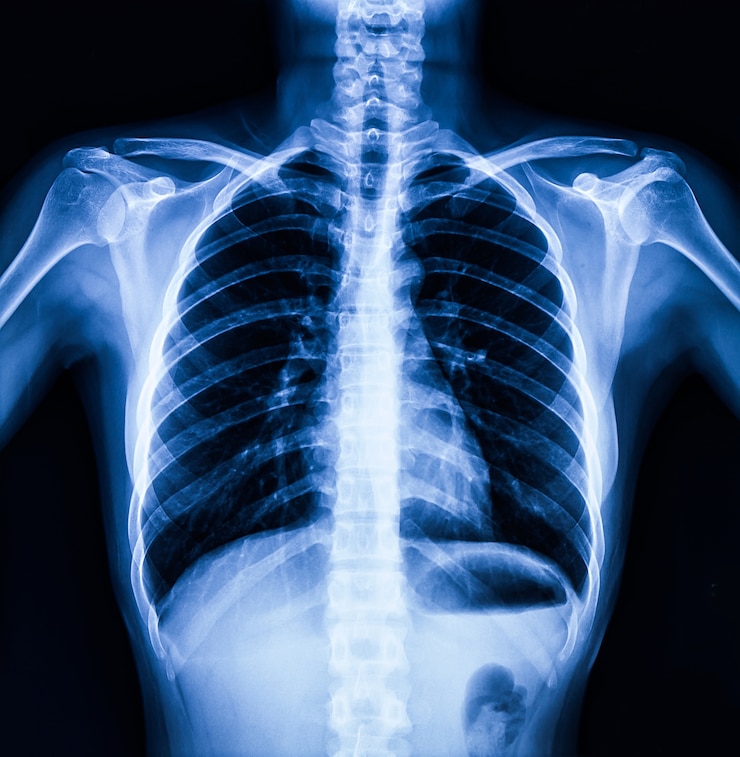 Photo radiographie du thorax