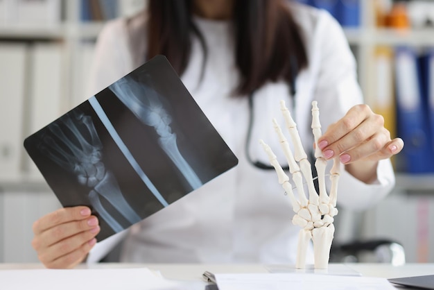 Radiographie de la main entre les mains d'un médecin floue