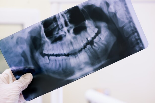 Radiographie panoramique des dents dans les mains de l'homme