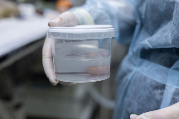 Photo récipient avec biopsie tumorale pour l'examen histologique sélection du matériel biologique