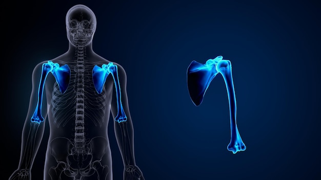 Rendu 3D d'un os de l'épaule disloqué