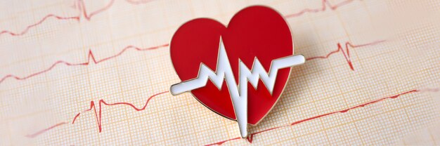 Photo le résultat de l'électrocardiogramme avec l'icône se trouve sur la table. examen du concept du système cardiovasculaire