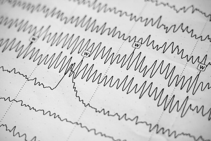 Résultat de l'électroencéphalogramme sur papier gros plan test d'activité cérébrale