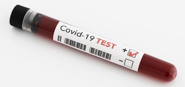 Résultat positif du test sanguin