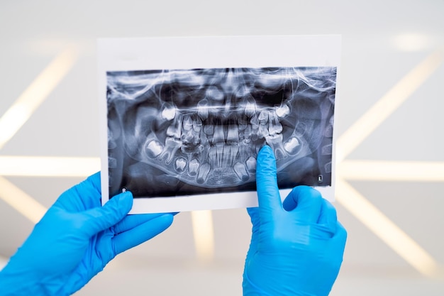 Résultats de rayons X dentaires tenant dans les mains l'analyse des dents de stomatologie