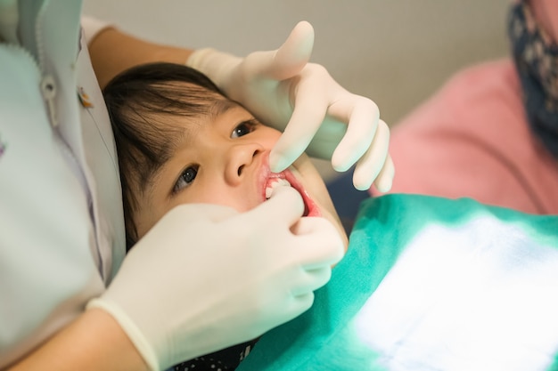 Le revêtement Fluoride chez les enfants