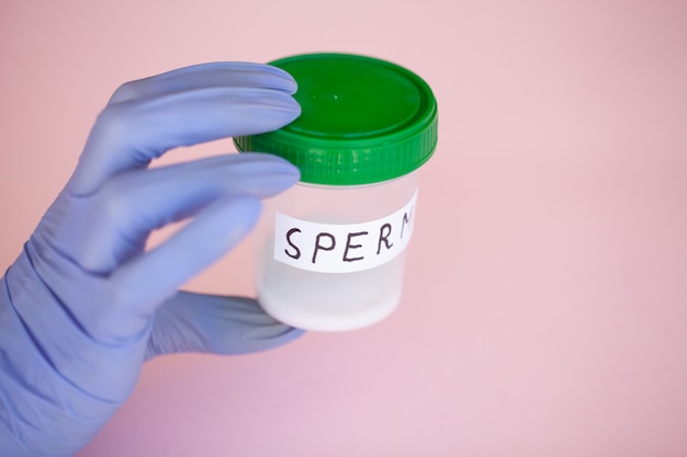 Photo santé. analyse de sperme. concept de sperme de banque. infertilité. doctor's hand holding container pour les analyses.