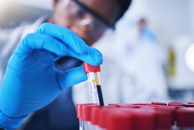 Science sang et mains avec tube à essai en laboratoire pour la recherche examen médical et analyse d'échantillons Scientifique pharmaceutique et homme noir de la santé avec flacon pour expérience adn arn et génétique