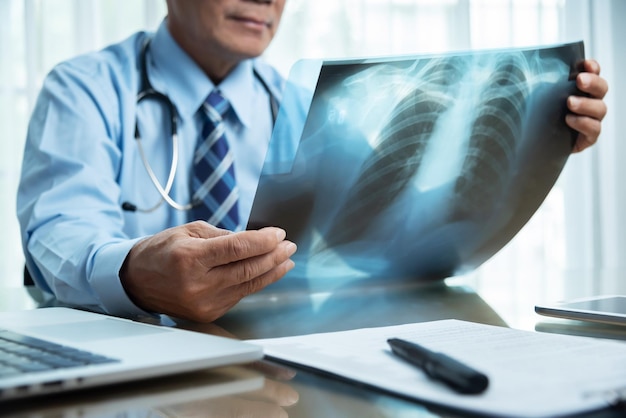 Section médiane du médecin tenant une radiographie médicale sur la table