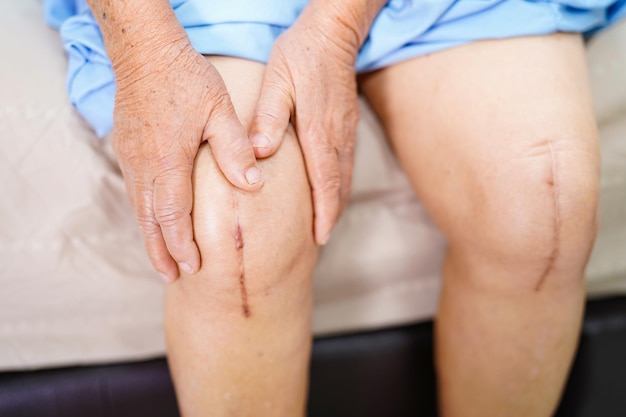 Photo section médiane d'une femme âgée avec une jambe blessée assise sur un lit à l'hôpital