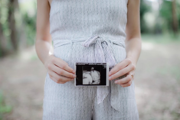 Section médiane d'une femme enceinte tenant des rayons X alors qu'elle se tient à l'extérieur