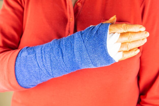 Photo section médiane d'une femme avec une fracture de la main