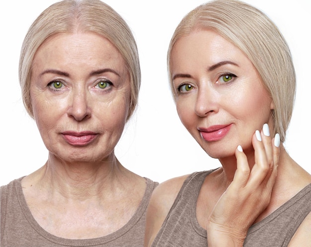 Soins de la peau du visage et du cou à l'âge adulte Avant et après
