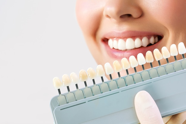 Souriante jeune femme. Blanchiment cosmétologique des dents dans une clinique dentaire. sélection du ton du