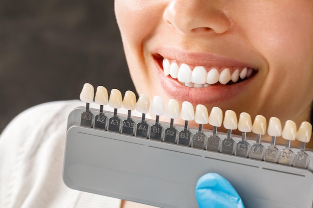 Souriante jeune femme blanchissant les dents cosmétologiques dans une clinique dentaire sélection du ton de la