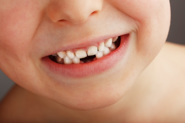 Un sourire d'enfant sans dents de bébé inférieures. Un trou dans le sourire d'un enfant. Concept amusant.