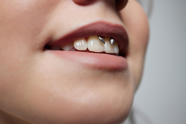 Sourire ou piercing au frein sous la lèvre supérieure