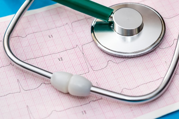 Stéthoscope sur cardiogramme sur bleu.