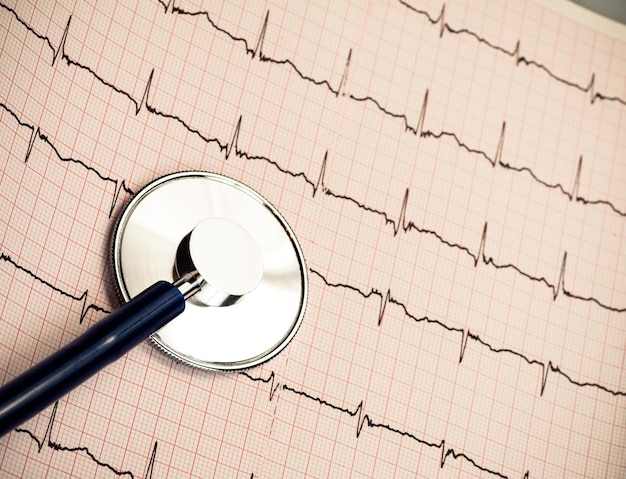 Stéthoscope sur ECG