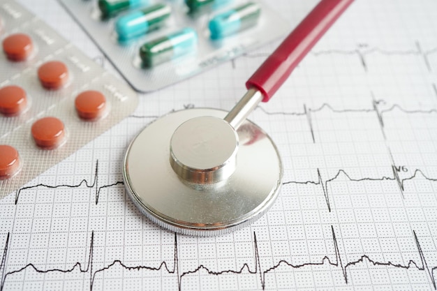 Stéthoscope sur électrocardiogramme ECG avec rapport de cardiogramme de crise cardiaque d'onde cardiaque de drogue