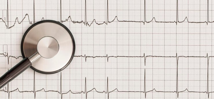 Stéthoscope sur le fond du cardiogramme. Vue de dessus. Mise à plat. Notion de médecine.