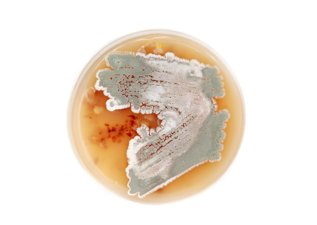 Streptomyces sur une plaque d'agar