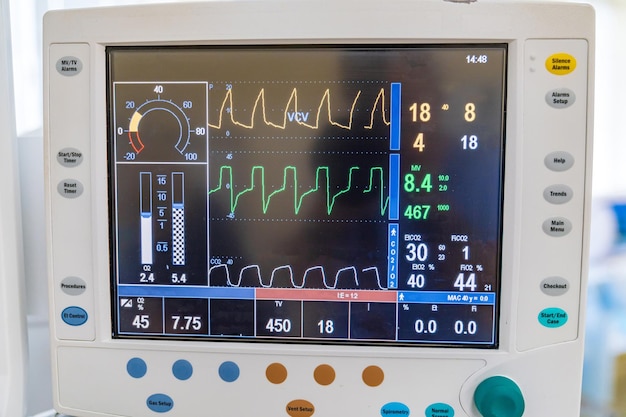 Surveillance des soins hospitaliers Moniteurs médicaux modernes