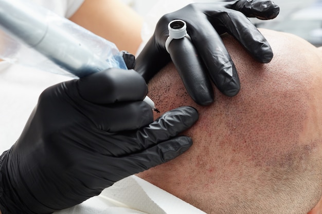 Tatoueur professionnel fabriquant une tricopigmentation permanente