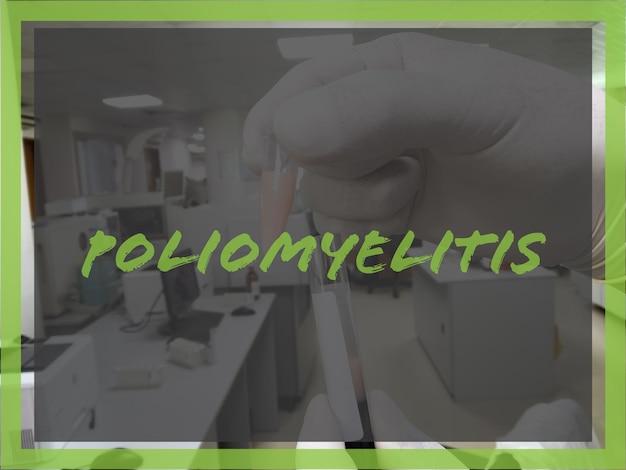 Photo terme du virus de la poliomyélite et de la poliomyélite pour l'image conceptuelle médicale