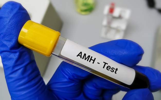 Test AMH (hormone anti-mullérienne), test de la fonction ovarienne et de la fertilité pour les femmes