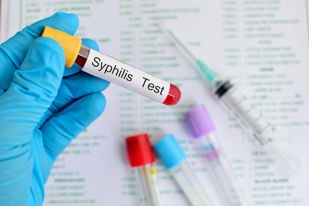 Photo test du sang pour la syphilis