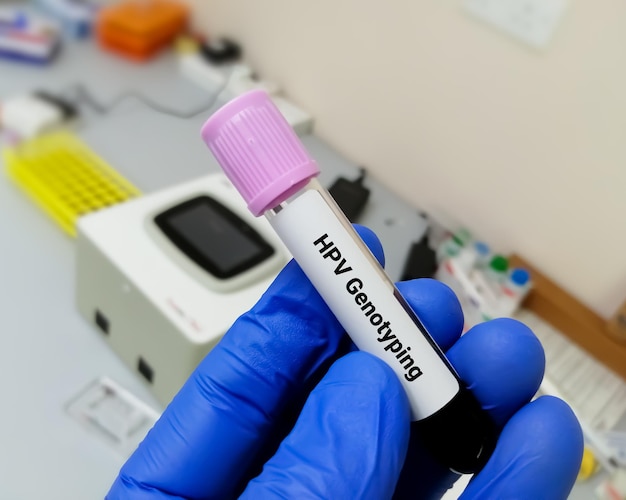 Test PCR de génotypage du papillomavirus humain