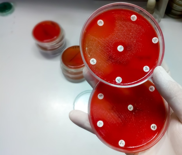 Test de résistance aux antibiotiques des bactéries