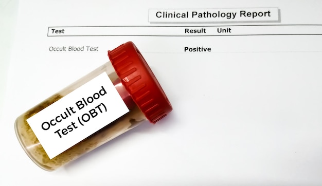 Test de sang occulte (OBT) avec rapport de patient anormal.