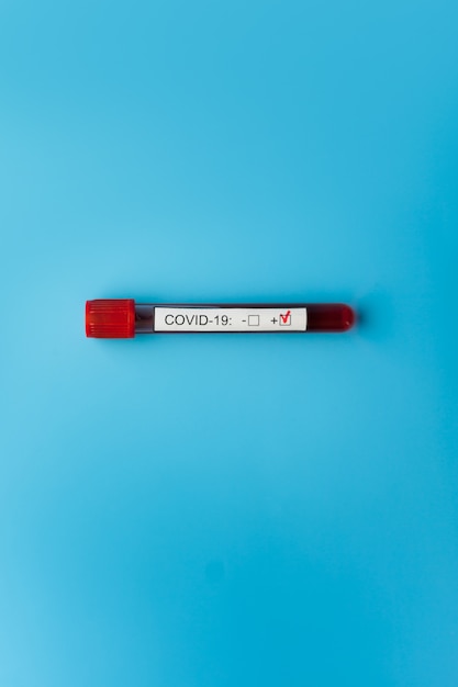 Test sanguin positif pour le nouveau coronavirus à propagation rapide