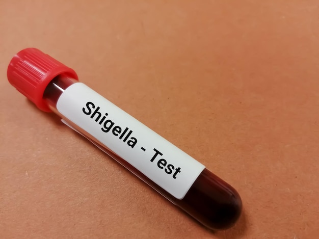 Test de Shigella, un type de bactérie provoquant une infection appelée shigellose