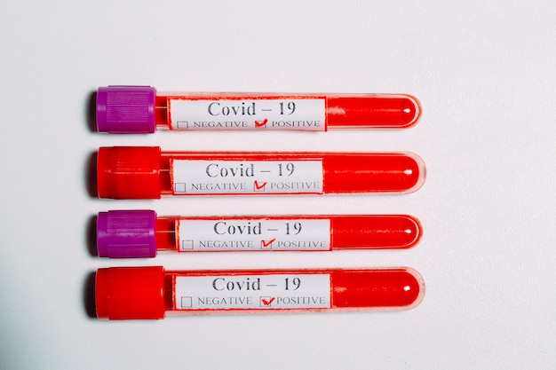 Tests sanguins positifs pour le coronavirus dans des tubes à essai.